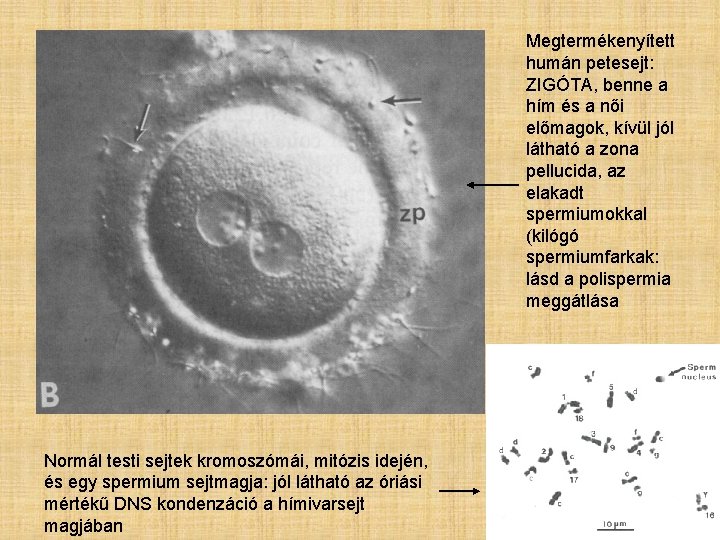 Megtermékenyített humán petesejt: ZIGÓTA, benne a hím és a női előmagok, kívül jól látható