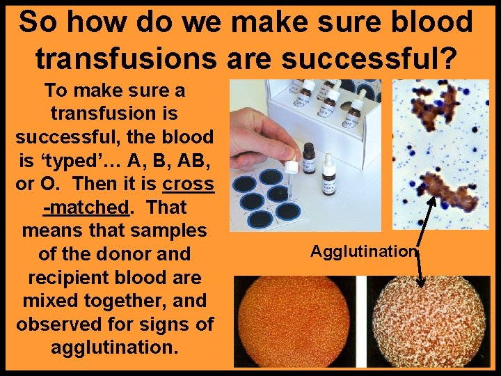 So how do we make sure blood transfusions are successful? To make sure a