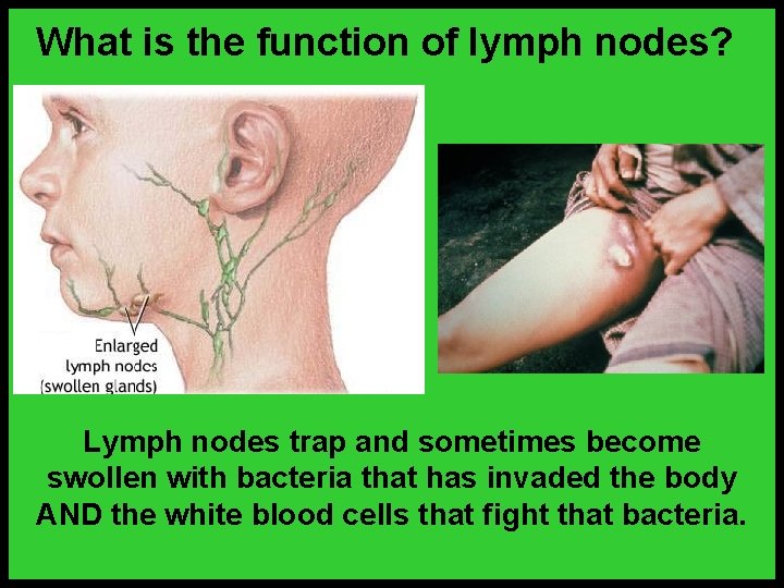 What is the function of lymph nodes? Lymph nodes trap and sometimes become swollen