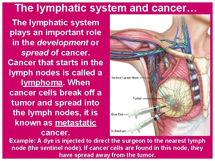 The lymphatic system and cancer… The lymphatic system plays an important role in the