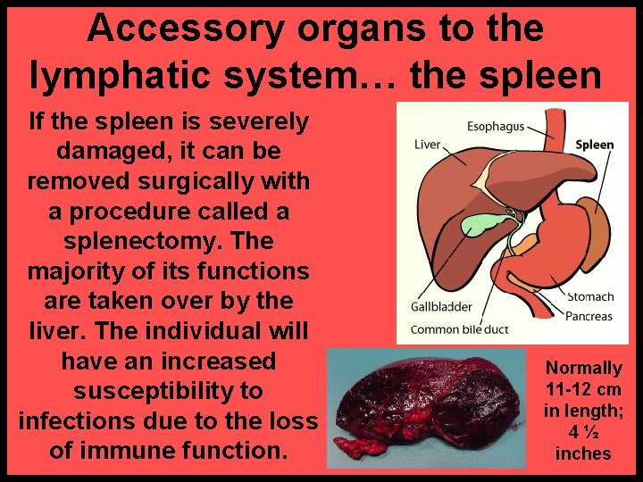 Accessory organs to the lymphatic system… the spleen If the spleen is severely damaged,