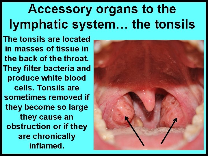 Accessory organs to the lymphatic system… the tonsils The tonsils are located in masses