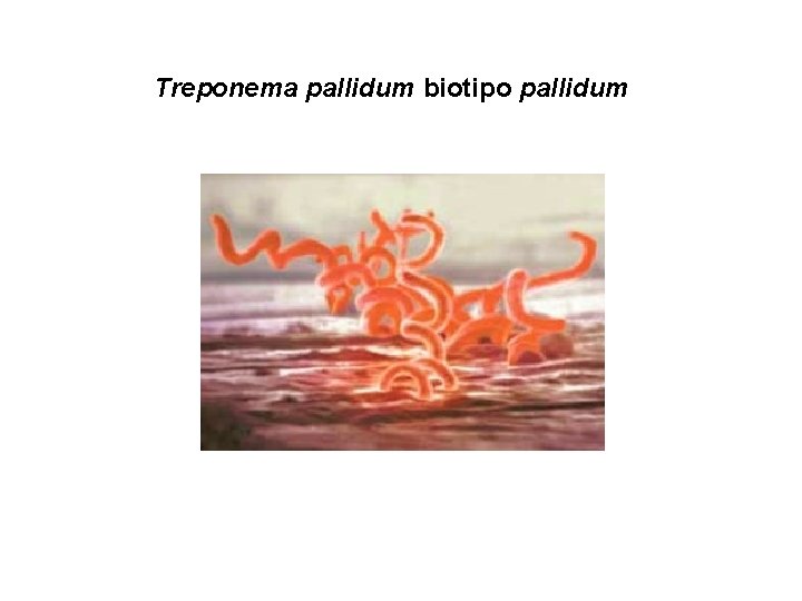 Treponema pallidum biotipo pallidum 