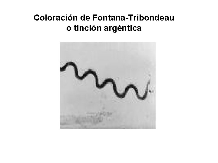 Coloración de Fontana-Tribondeau o tinción argéntica 