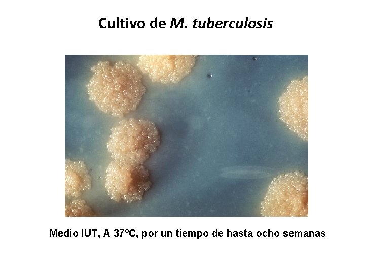 Cultivo de M. tuberculosis Medio IUT, A 37°C, por un tiempo de hasta ocho
