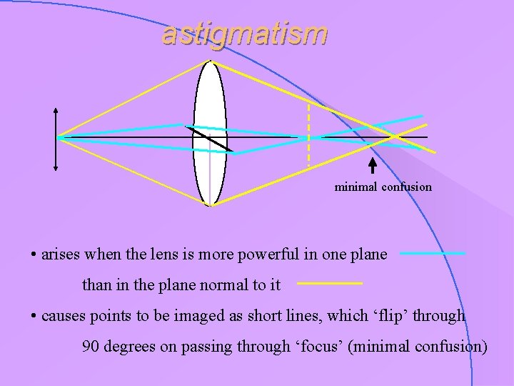 astigmatism minimal confusion • arises when the lens is more powerful in one plane