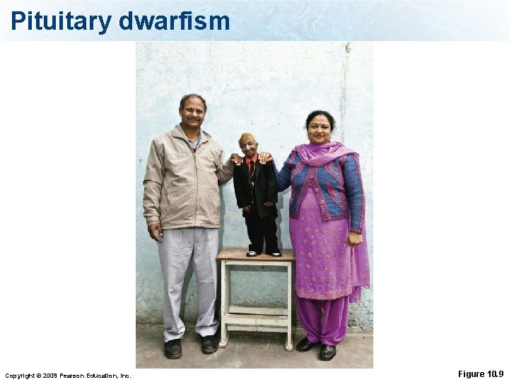 Pituitary dwarfism Copyright © 2009 Pearson Education, Inc. Figure 10. 9 