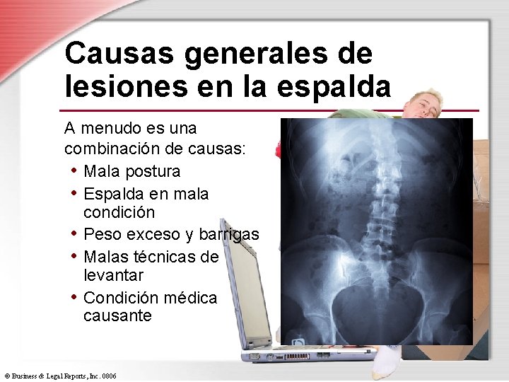 Causas generales de lesiones en la espalda A menudo es una combinación de causas: