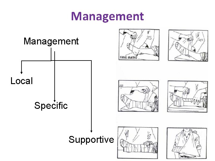 Management Local Specific Supportive 