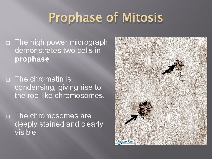 Prophase of Mitosis � The high power micrograph demonstrates two cells in prophase. �