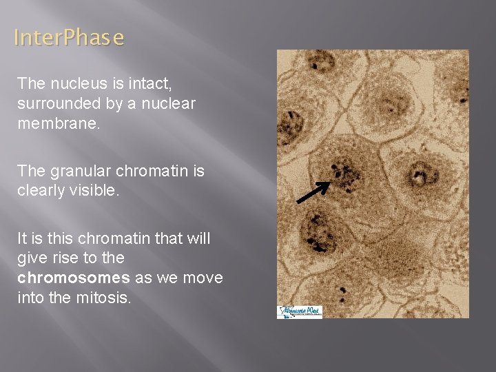 Inter. Phase The nucleus is intact, surrounded by a nuclear membrane. The granular chromatin