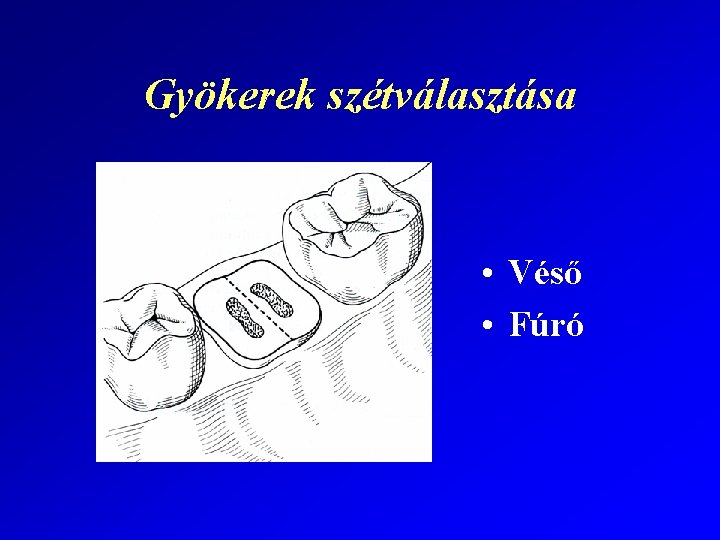 Gyökerek szétválasztása • Véső • Fúró 