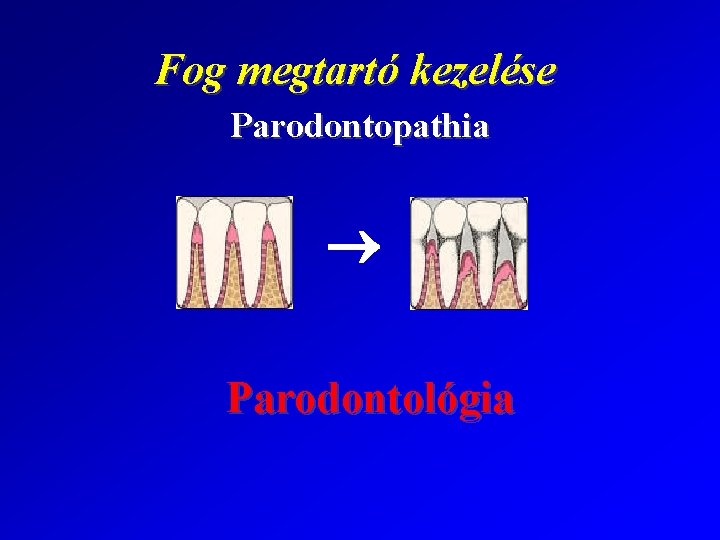 Fog megtartó kezelése Parodontopathia Parodontológia 