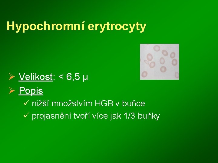 Hypochromní erytrocyty Ø Velikost: < 6, 5 μ Ø Popis ü nižší množstvím HGB