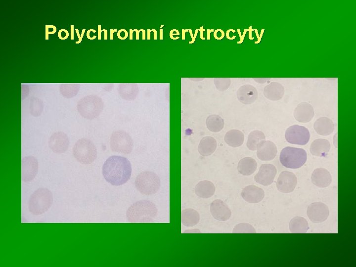 Polychromní erytrocyty 