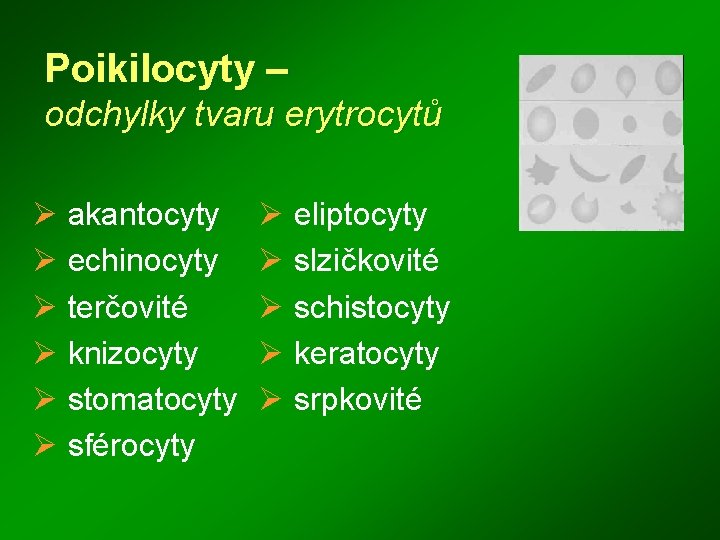 Poikilocyty – odchylky tvaru erytrocytů Ø akantocyty Ø echinocyty Ø terčovité Ø knizocyty Ø