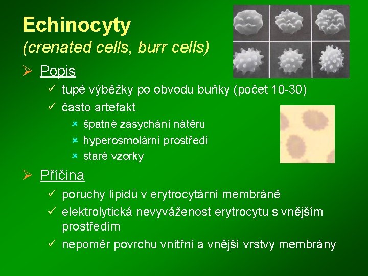 Echinocyty (crenated cells, burr cells) Ø Popis ü tupé výběžky po obvodu buňky (počet