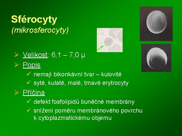 Sférocyty (mikrosferocyty) Ø Velikost: 6, 1 – 7, 0 μ Ø Popis ü nemají