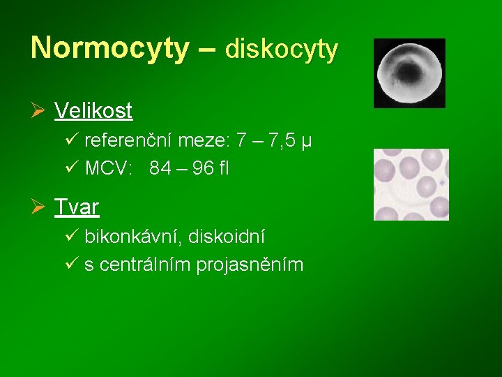 Normocyty – diskocyty Ø Velikost ü referenční meze: 7 – 7, 5 μ ü