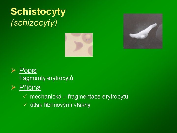 Schistocyty (schizocyty) Ø Popis fragmenty erytrocytů Ø Příčina ü mechanická – fragmentace erytrocytů ü