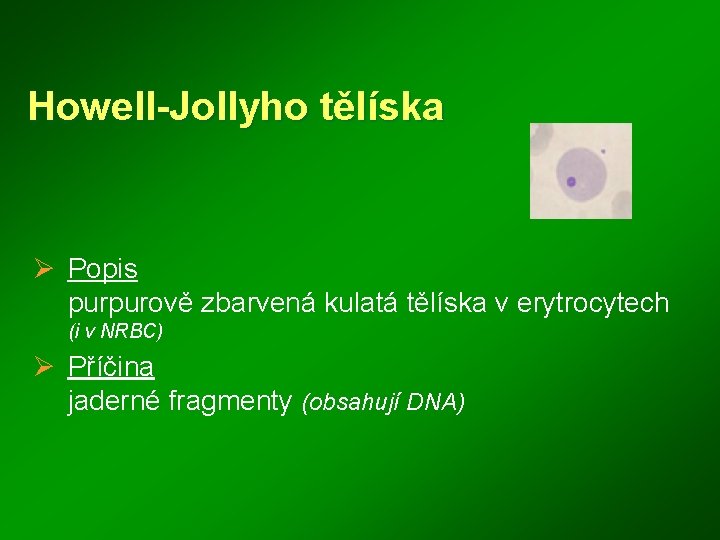 Howell-Jollyho tělíska Ø Popis purpurově zbarvená kulatá tělíska v erytrocytech (i v NRBC) Ø