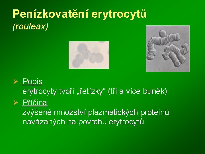 Penízkovatění erytrocytů (rouleax) Ø Popis erytrocyty tvoří „řetízky“ (tři a více buněk) Ø Příčina