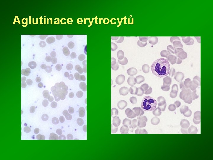 Aglutinace erytrocytů 