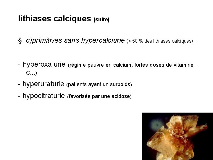 lithiases calciques (suite) § c)primitives sans hypercalciurie (> 50 % des lithiases calciques) - lithiases calciques (suite) § c)primitives sans hypercalciurie (> 50 % des lithiases calciques) -