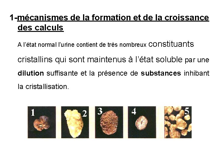 1 -mécanismes de la formation et de la croissance des calculs A l’état normal 1 -mécanismes de la formation et de la croissance des calculs A l’état normal