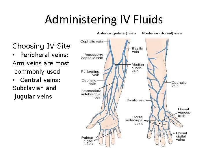 Administering IV Fluids Choosing IV Site • Peripheral veins: Arm veins are most commonly