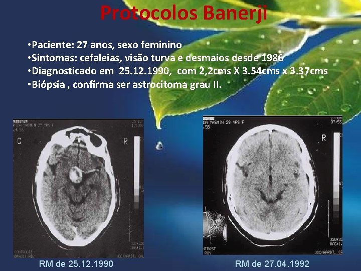 Protocolos Banerji • Paciente: 27 anos, sexo feminino • Sintomas: cefaleias, visão turva e