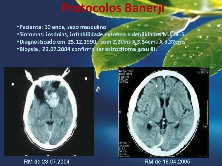 Protocolos Banerji • Paciente: 60 anos, sexo masculino • Sintomas: insónias, irritabilidade extrema e