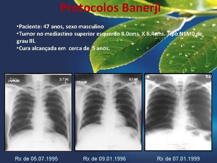 Protocolos Banerji • Paciente: 47 anos, sexo masculino • Tumor no mediastino superior esquerdo