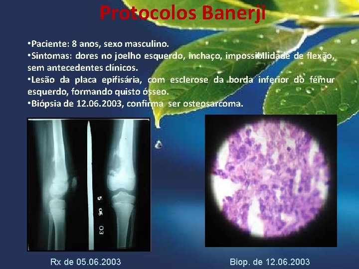 Protocolos Banerji • Paciente: 8 anos, sexo masculino. • Sintomas: dores no joelho esquerdo,