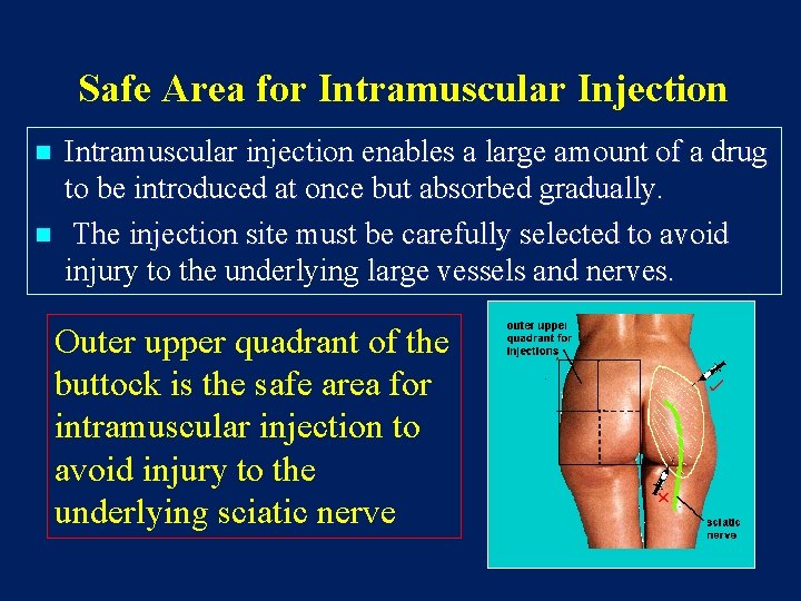 Safe Area for Intramuscular Injection n n Intramuscular injection enables a large amount of