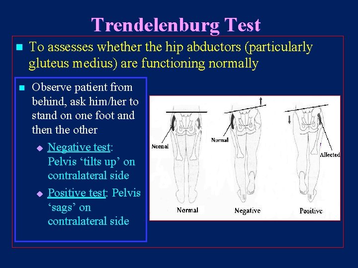 Trendelenburg Test n n To assesses whether the hip abductors (particularly gluteus medius) are