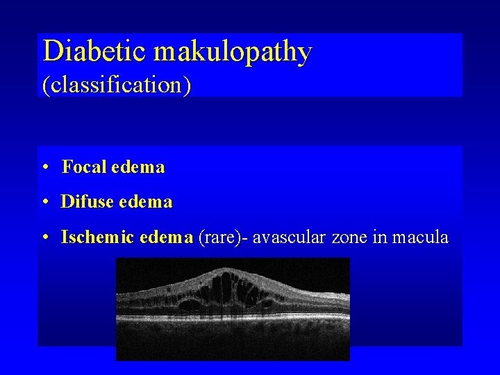 Diabetic makulopathy (classification) • Focal edema • Difuse edema • Ischemic edema (rare)- avascular