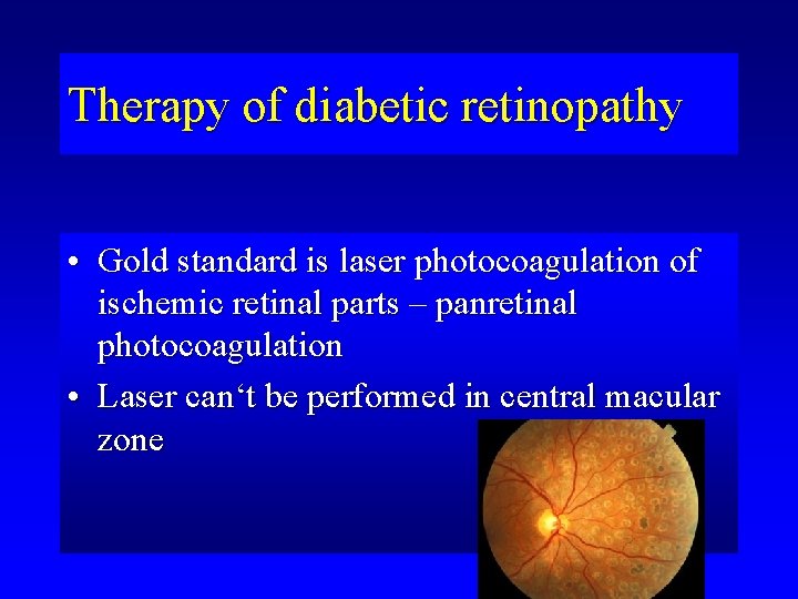 Therapy of diabetic retinopathy • Gold standard is laser photocoagulation of ischemic retinal parts