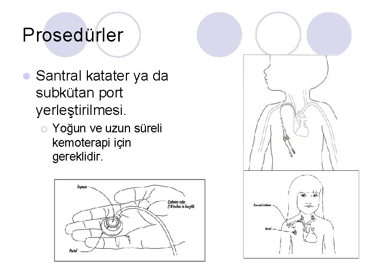 Prosedürler l Santral katater ya da subkütan port yerleştirilmesi. ¡ Yoğun ve uzun süreli