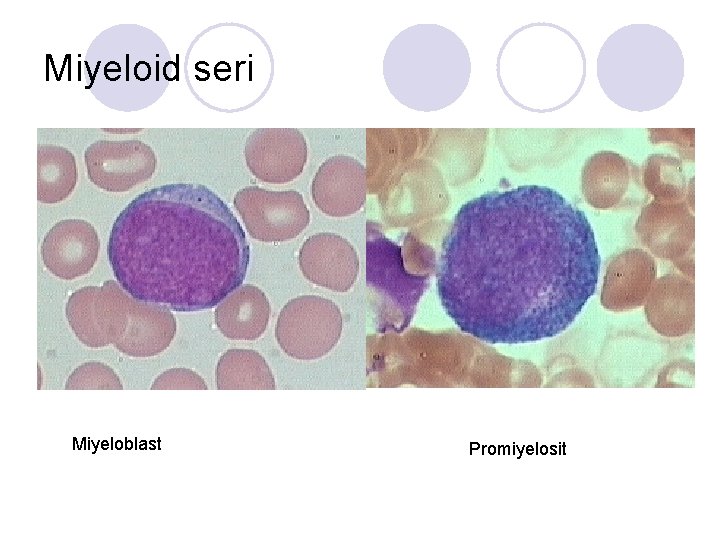 Miyeloid seri Miyeloblast Promiyelosit 