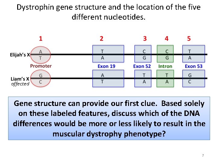 Dystrophin gene structure and the location of the five different nucleotides. affected Gene structure