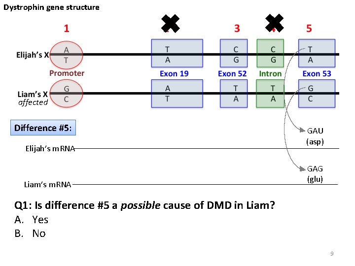 Dystrophin gene structure ✖ ✖ affected Difference #5: Elijah’s m. RNA Liam’s m. RNA