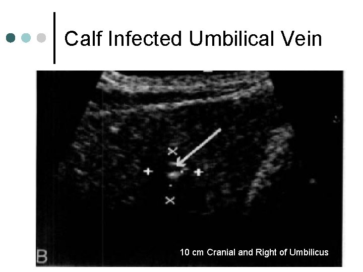 Calf Infected Umbilical Vein 10 cm Cranial and Right of Umbilicus 