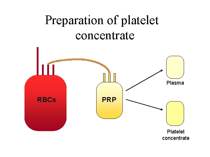 Preparation of platelet concentrate Plasma RBCs PRP Platelet concentrate Preparation of platelet concentrate Plasma RBCs PRP Platelet concentrate