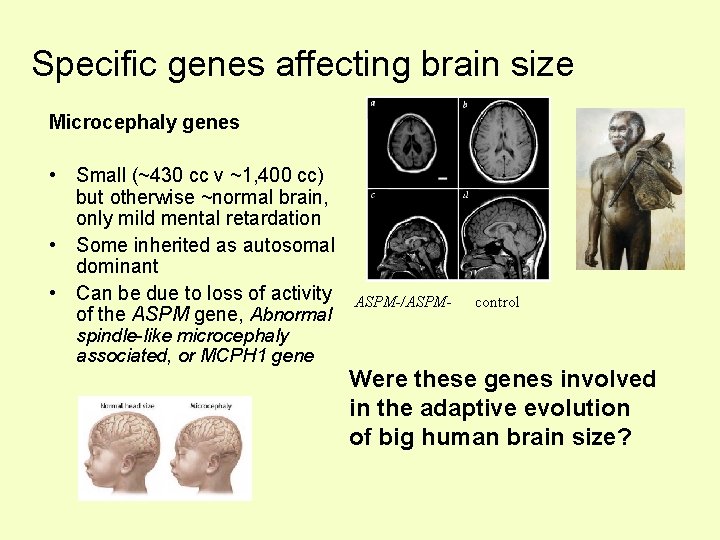 Specific genes affecting brain size Microcephaly genes • Small (~430 cc v ~1, 400