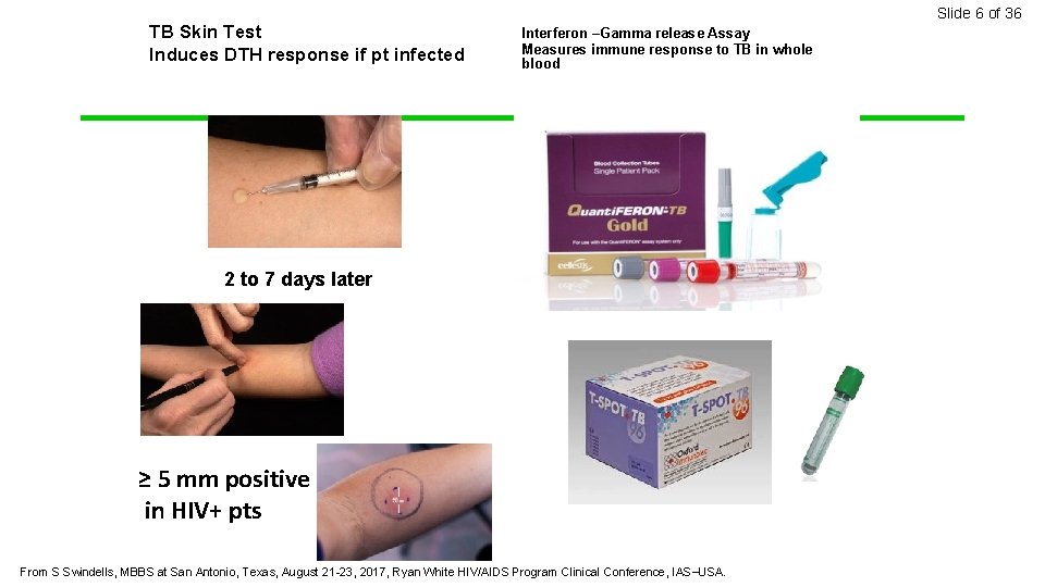 Slide 6 of 36 TB Skin Test Induces DTH response if pt infected Interferon