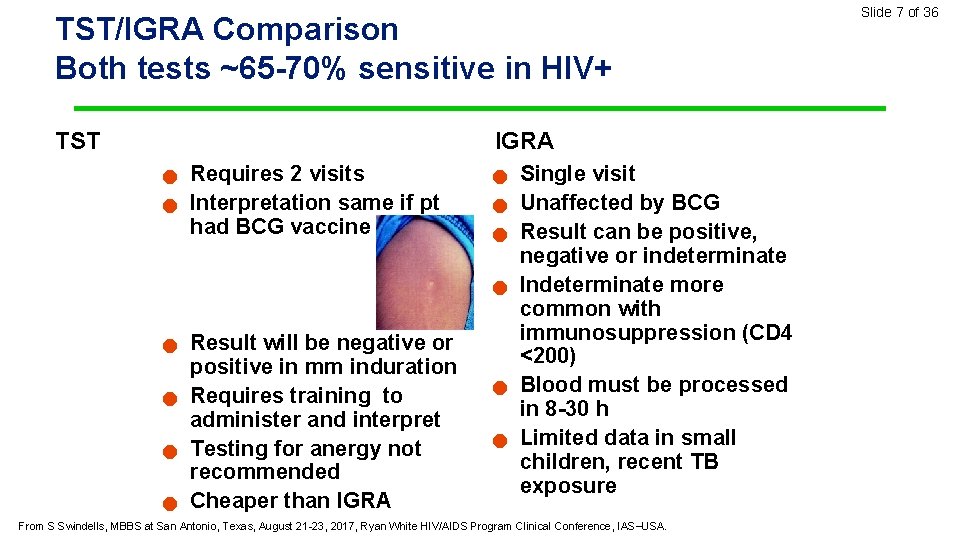 TST/IGRA Comparison Both tests ~65 -70% sensitive in HIV+ TST IGRA n n Requires