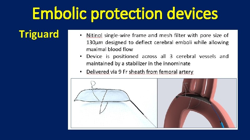 Embolic protection devices Triguard 