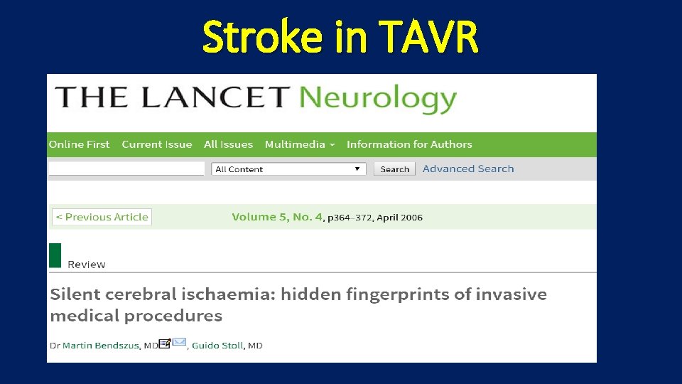 Stroke in TAVR Silent CNS infarction in TAVR 