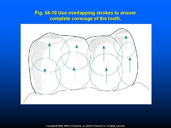 Fig. 58 -10 Use overlapping strokes to ensure complete coverage of the tooth. Copyright